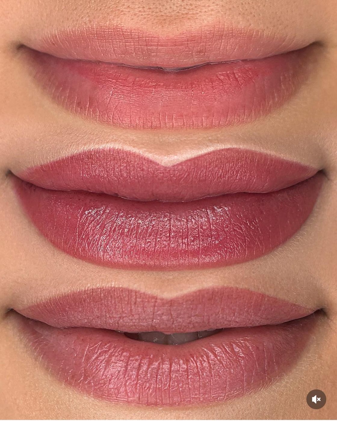 Lip color healing stages